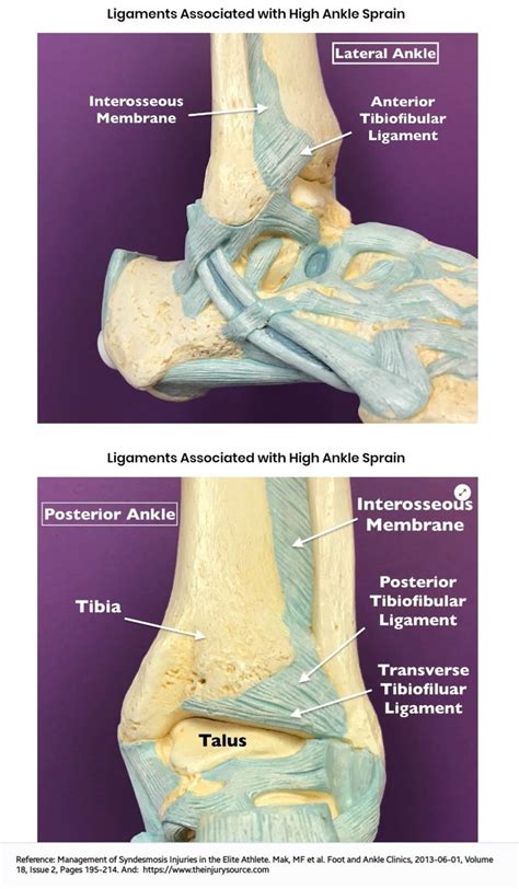 test for interosseous membrane tear|Syndesmotic Ankle Sprains .